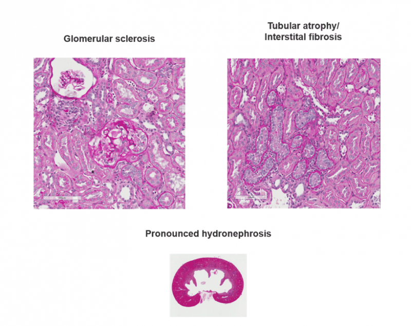 ZDF Rat Model of Diabetic Nephropathy Sygnature Discovery